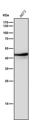 All lanes use the Antibody at 1:2k dilution for 1 hour at room temperature.