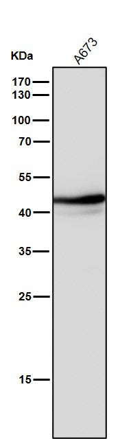 All lanes use the Antibody at 1:2k dilution for 1 hour at room temperature.