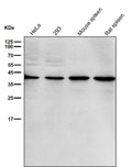 All lanes use the Antibody at 1:3K dilution for 1 hour at room temperature.