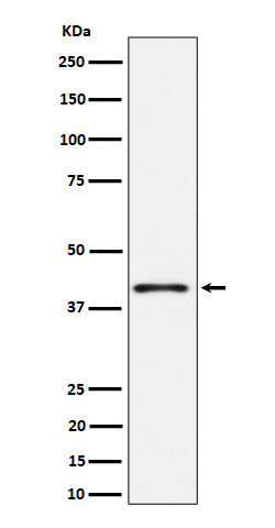 Western blot analysis of Phospho-p38 (T180) expression in HeLa treated with anisomycin cell lysate.