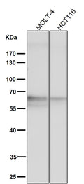 All lanes use the Antibody at 1:3K dilution for 1 hour at room temperature.