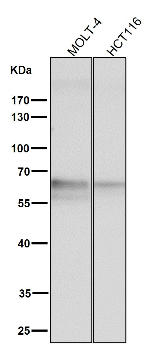 All lanes use the Antibody at 1:3K dilution for 1 hour at room temperature.