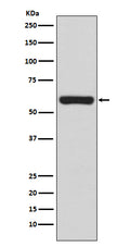 Anti-TRAF6 Rabbit Monoclonal Antibody