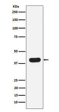 Western blot analysis of HLA B7 expression in Ramos cell lysate.