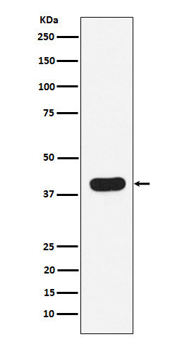 Western blot analysis of HLA B7 expression in Ramos cell lysate.