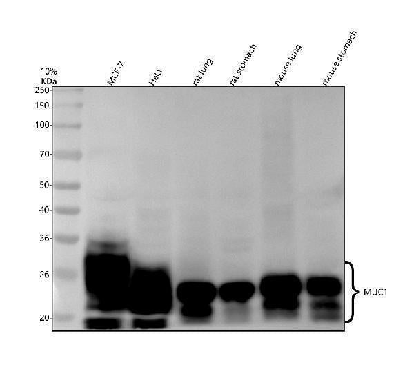 Anti-MUC1 Rabbit Monoclonal Antibody