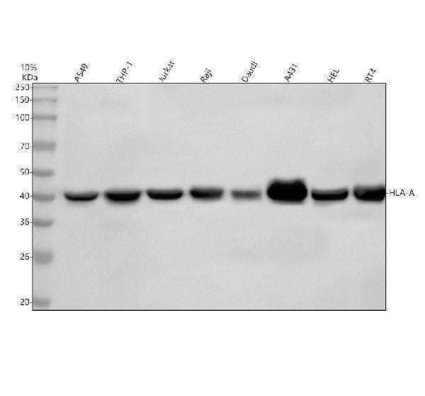 Anti-MHC class 1 HLA-A Rabbit Monoclonal Antibody