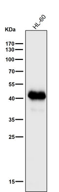 All lanes use the Antibody at 1:1K dilution for 1 hour at room temperature.