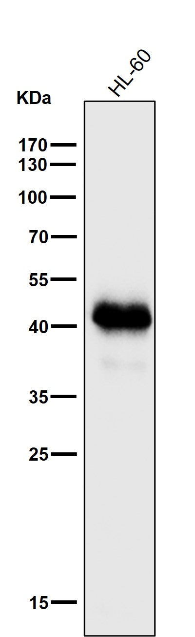 All lanes use the Antibody at 1:1K dilution for 1 hour at room temperature.