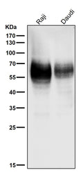 All lanes use the Antibody at 1:1K dilution for 1 hour at room temperature.