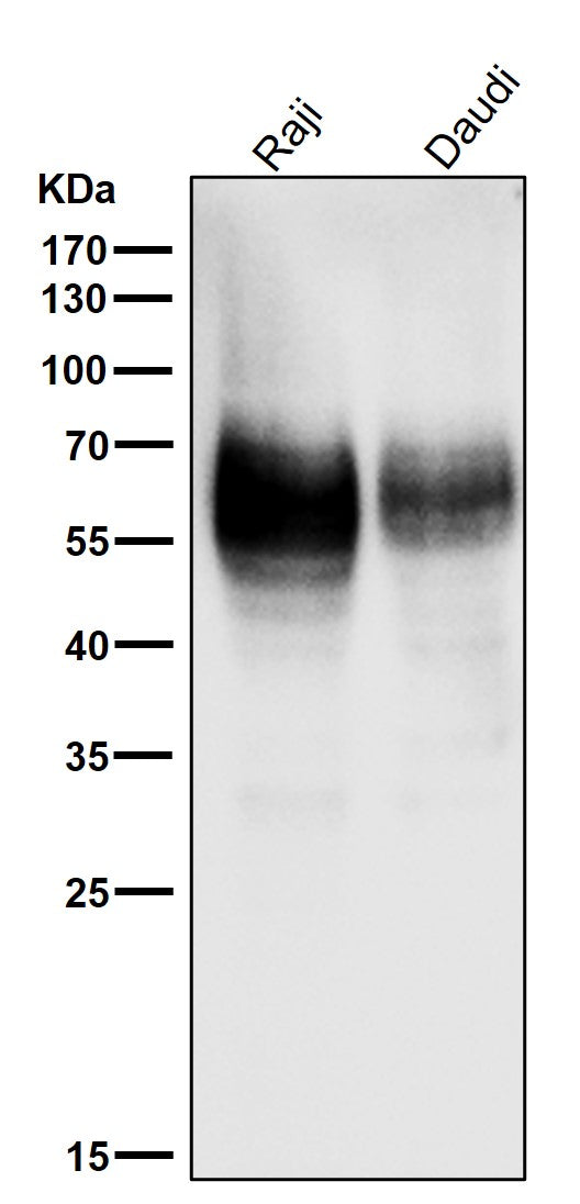 All lanes use the Antibody at 1:1K dilution for 1 hour at room temperature.