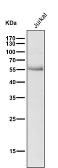 Anti-Wilms Tumor Protein WT1 Rabbit Monoclonal Antibody
