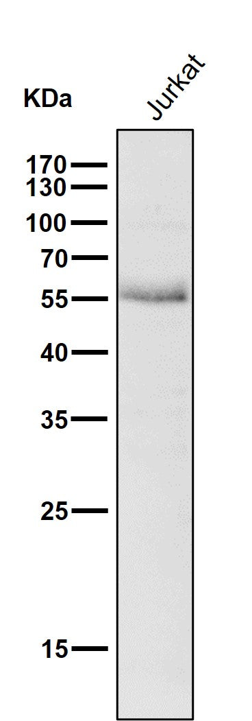 Anti-Wilms Tumor Protein WT1 Rabbit Monoclonal Antibody