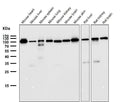 All lanes use the Antibody at 1:5K dilution for 1 hour at room temperature.