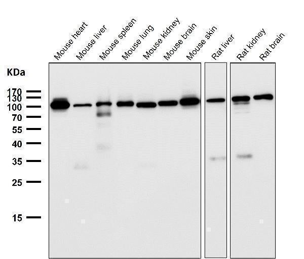 All lanes use the Antibody at 1:5K dilution for 1 hour at room temperature.