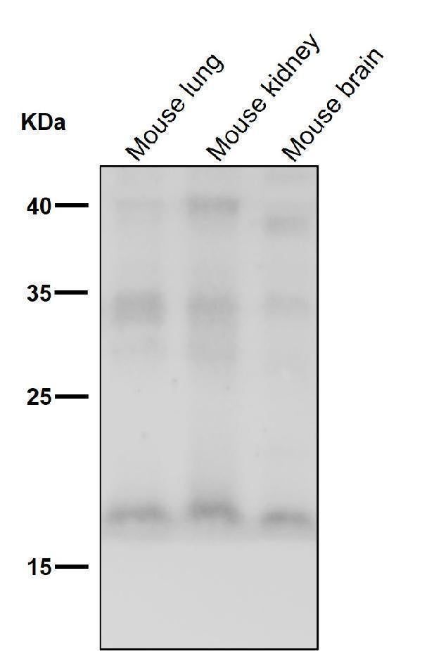 Anti-FGF1 Rabbit Monoclonal Antibody