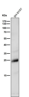 All lanes use the Antibody at 1:1K dilution for 1 hour at room temperature.