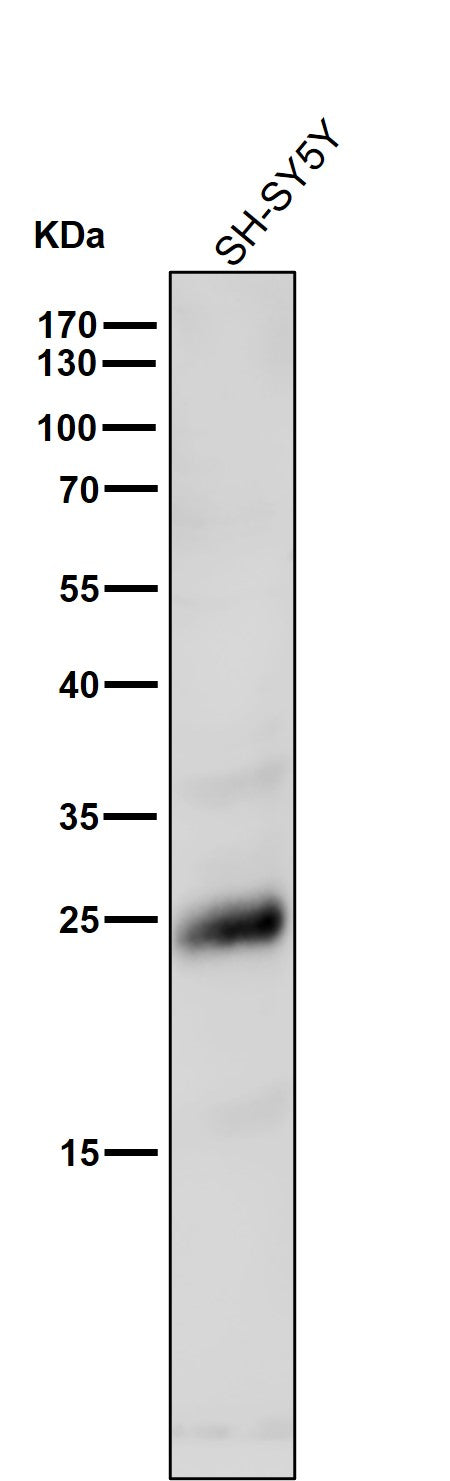 All lanes use the Antibody at 1:1K dilution for 1 hour at room temperature.
