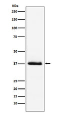 Western blot analysis of Parathyroid Hormone expression in human Parathyroid Hormone recombinant protein.