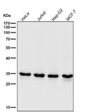 All lanes use the Antibody at 1:1K dilution for 1 hour at room temperature.