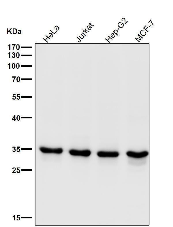 All lanes use the Antibody at 1:1K dilution for 1 hour at room temperature.