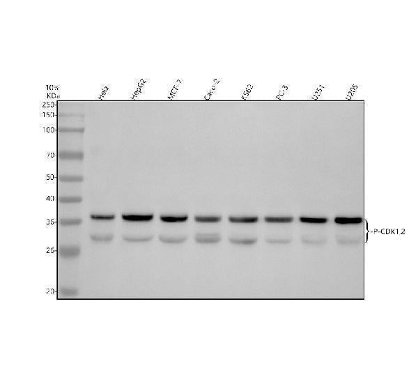 Anti-Phospho-CDK2(T160)+CDK1(T161) Rabbit Monoclonal Antibody