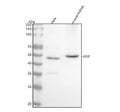 Anti-Vitamin D Receptor VDR Rabbit Monoclonal Antibody