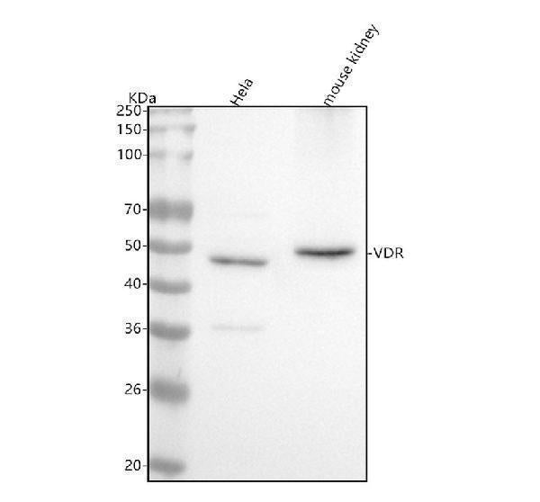 Anti-Vitamin D Receptor VDR Rabbit Monoclonal Antibody