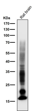 All lanes use the Antibody at 1:5K dilution for 1 hour at room temperature.