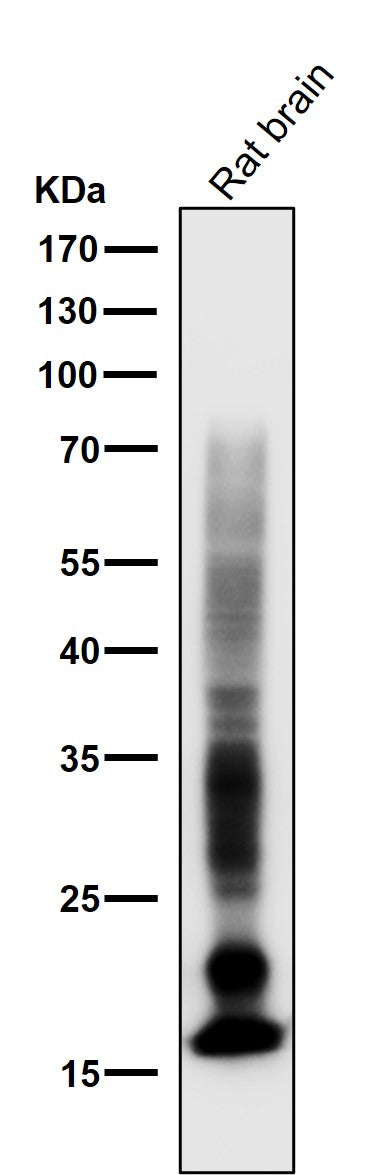 All lanes use the Antibody at 1:5K dilution for 1 hour at room temperature.