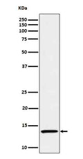 Western blot analysis of IL15 in Recombinant human IL-15 protein cell lysate.