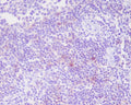 Immunohistochemical analysis of paraffin-embedded human tonsil, using CD25 Antibody.