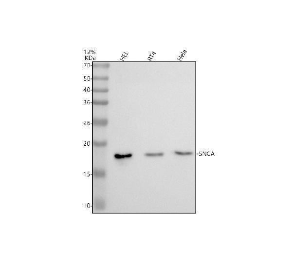 Anti-Alpha Synuclein SNCA Rabbit Monoclonal Antibody