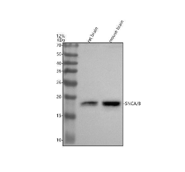 Anti-alpha + beta Synuclein SNCA Rabbit Monoclonal Antibody