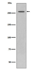 Western blot analysis of LRRK2 expression in GFP-LRRK2 lysate.