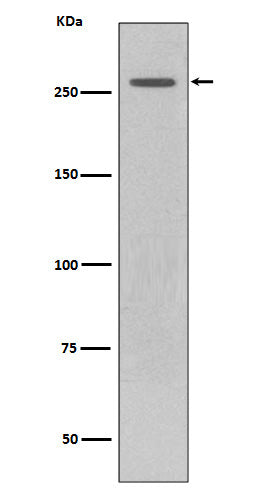 Western blot analysis of LRRK2 expression in GFP-LRRK2 lysate.