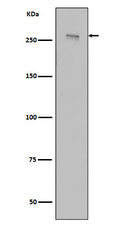 Western blot analysis of LRRK2 in HEK293 cell lysate transfected with 3*Flag wild type, full length LRRK2.