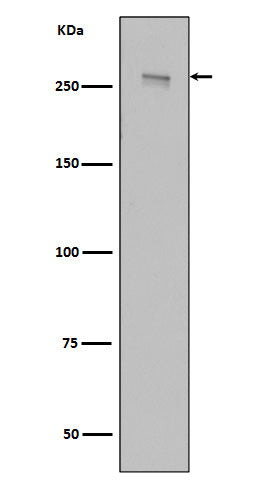 Western blot analysis of LRRK2 in HEK293 cell lysate transfected with 3*Flag wild type, full length LRRK2.