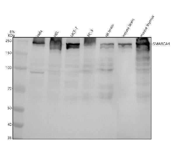 Anti-BRG1 Rabbit Monoclonal Antibody