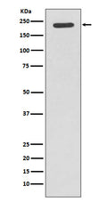 Western blot analysis of Tuberin expression in Jurkat cell lysate.