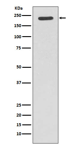 Western blot analysis of Tuberin expression in Jurkat cell lysate.