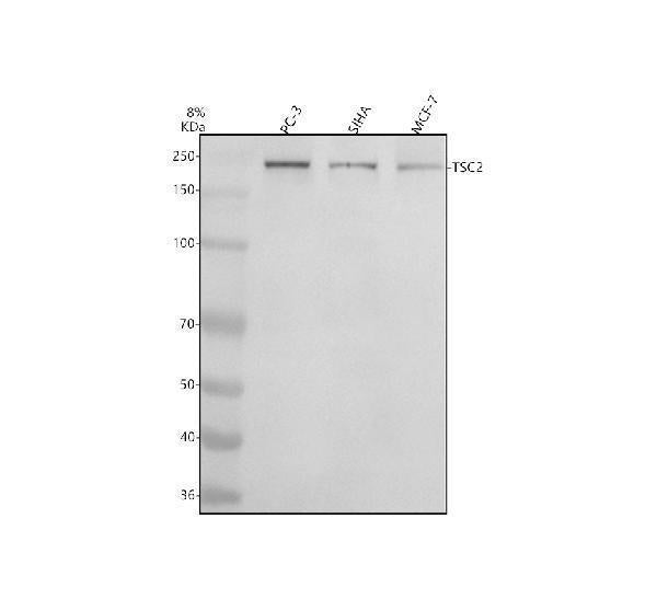 Anti-Phospho-Tuberin (S939) Rabbit Monoclonal Antibody