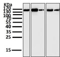 All lanes use the Antibody at 1:2K dilution for 1 hour at room temperature.
