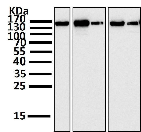 All lanes use the Antibody at 1:2K dilution for 1 hour at room temperature.