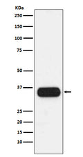 Western blot analysis of HLA-DQA1 expression in human spleen lysate.