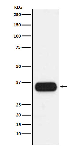 Western blot analysis of HLA-DQA1 expression in human spleen lysate.