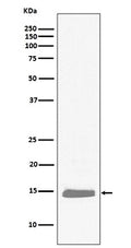 Anti-Hemoglobin subunit alpha HBA1 Rabbit Monoclonal Antibody
