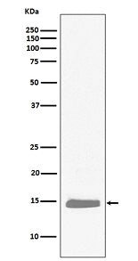Anti-Hemoglobin subunit alpha HBA1 Rabbit Monoclonal Antibody