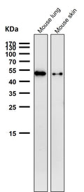 All lanes use the Antibody at 1:1K dilution for 1 hour at room temperature.