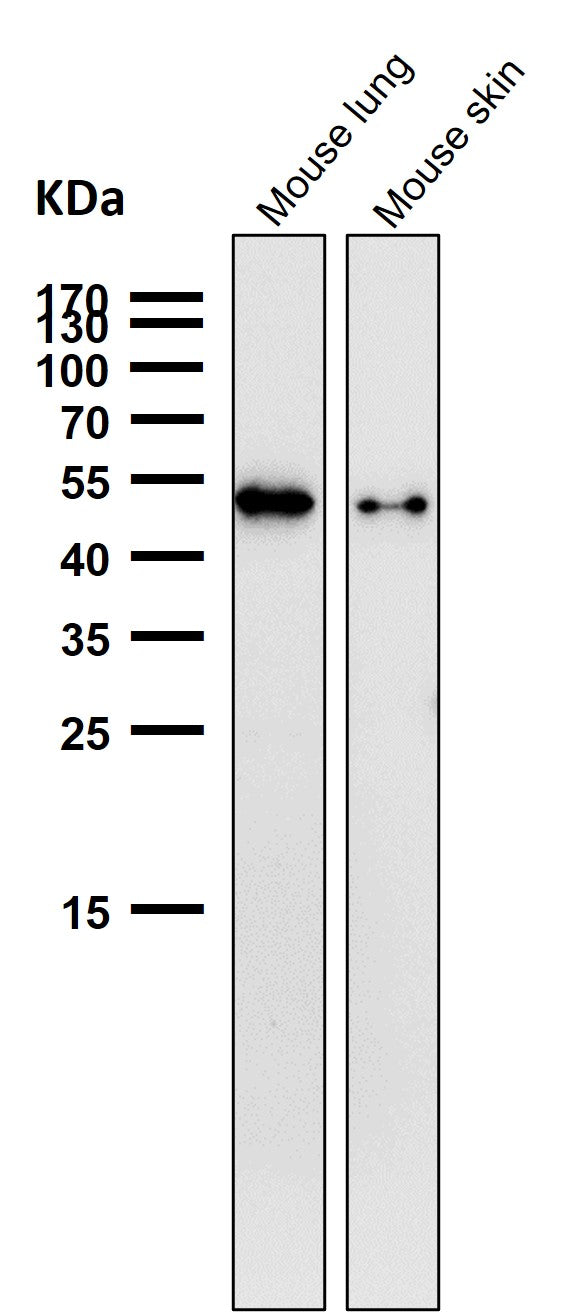 All lanes use the Antibody at 1:1K dilution for 1 hour at room temperature.